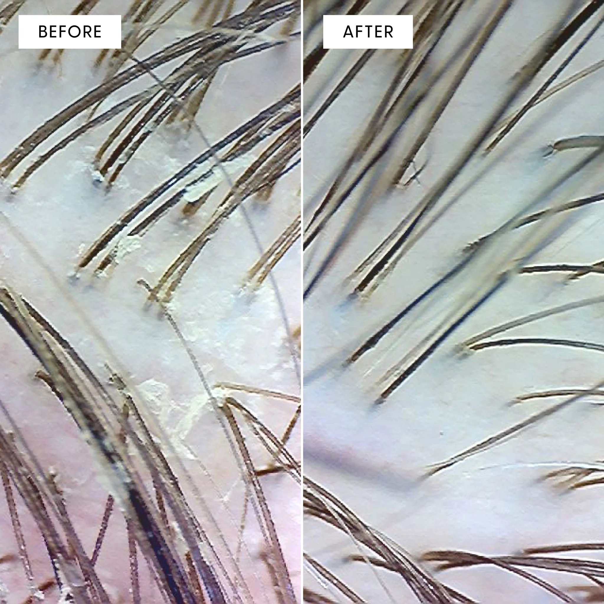 Scrub Scalp Exfoliant - Image 4